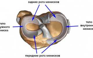 Менисцит внутреннего и медиального мениска коленного сустава