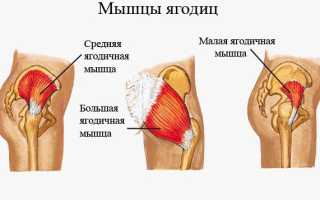 Почему возникают боли в области ягодиц и как их устранить?