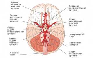 Гипоплазия левой/правой позвоночной артерии — что это такое?
